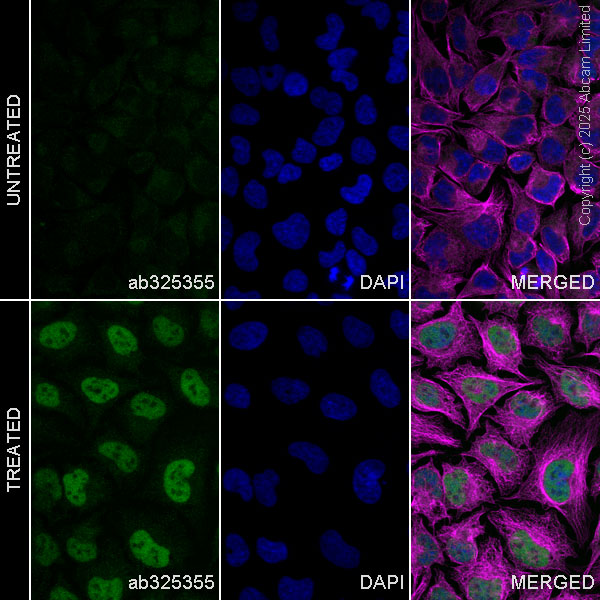Immunocytochemistry/ Immunofluorescence - Alexa Fluor® 594 Anti-alpha Tubulin antibody [EP1332Y] - Microtubule Marker (AB202272)