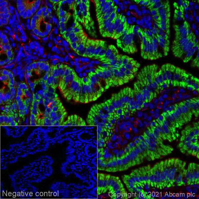 Immunohistochemistry (Formalin/PFA-fixed paraffin-embedded sections) - Alexa Fluor® 594 Anti-Arg2 antibody [EPR22626-38] (AB281774)