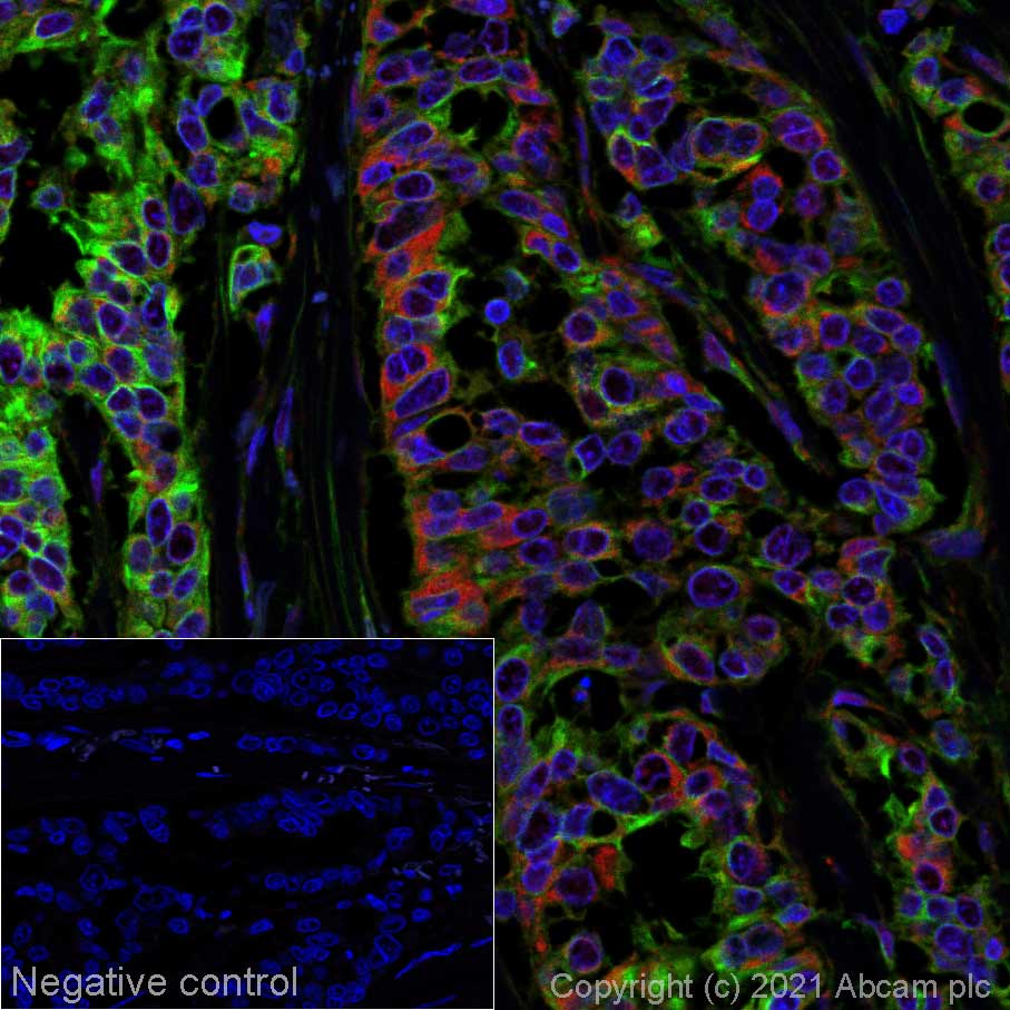 Immunohistochemistry (Formalin/PFA-fixed paraffin-embedded sections) - Alexa Fluor® 594 Anti-B7H4 antibody [EPR20236] (AB277937)