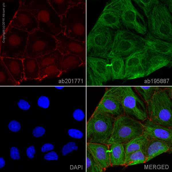 Immunocytochemistry/ Immunofluorescence - Alexa Fluor® 594 Anti-beta Catenin antibody [E247] (AB201771), expandable thumbnail