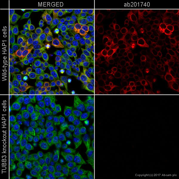 Immunocytochemistry/ Immunofluorescence - Alexa Fluor® 594 Anti-beta III Tubulin antibody [EP1569Y] - Neuronal Marker (AB201740)