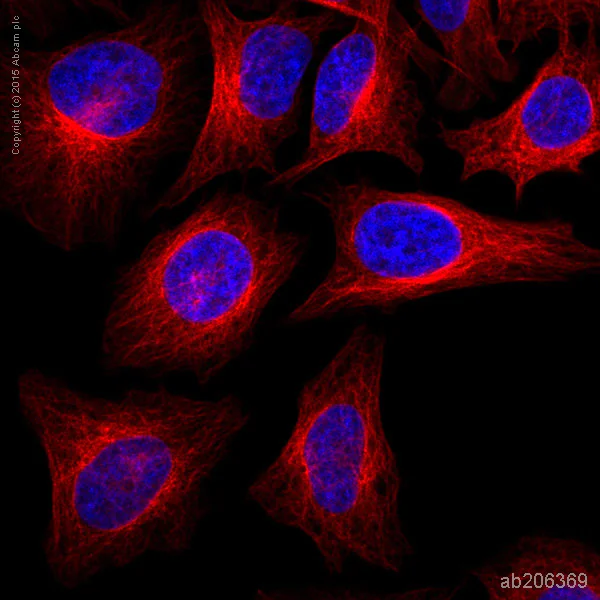 Immunocytochemistry/ Immunofluorescence - Alexa Fluor® 594 Anti-beta Tubulin antibody [EPR16774] - Microtubule Marker (AB206369)