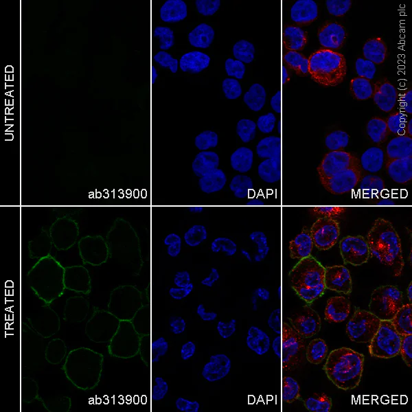 Immunocytochemistry/ Immunofluorescence - Alexa Fluor® 594 Anti-beta Tubulin antibody [EPR16774] - Microtubule Marker (AB206369)