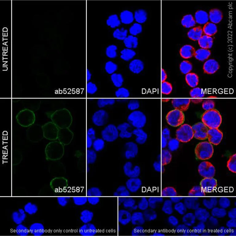 Immunocytochemistry/ Immunofluorescence - Alexa Fluor® 594 Anti-beta Tubulin antibody [EPR16774] - Microtubule Marker (AB206369)