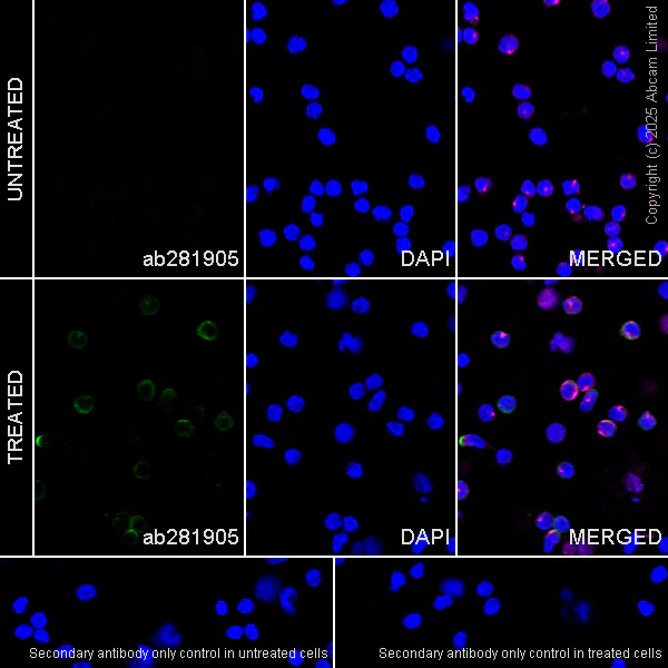 Immunocytochemistry/ Immunofluorescence - Alexa Fluor® 594 Anti-beta Tubulin antibody [EPR16774] - Microtubule Marker (AB206369)