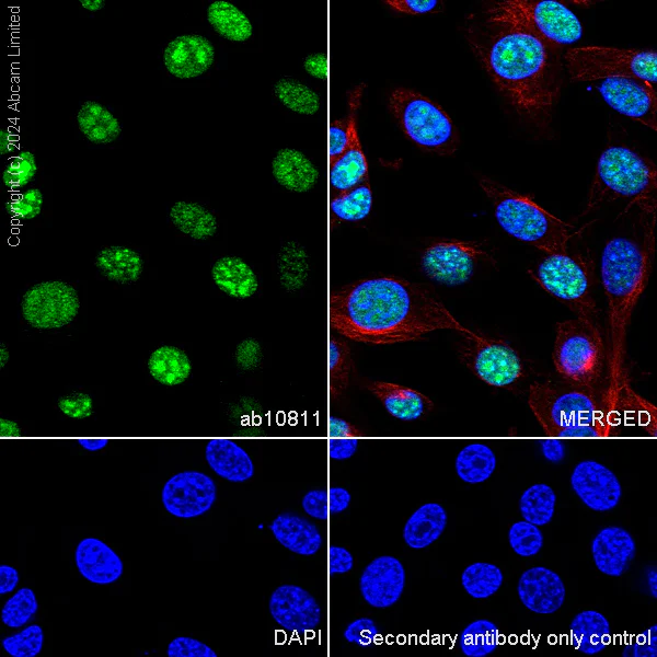 Immunocytochemistry/ Immunofluorescence - Alexa Fluor® 594 Anti-beta Tubulin antibody [EPR16774] - Microtubule Marker (AB206369)