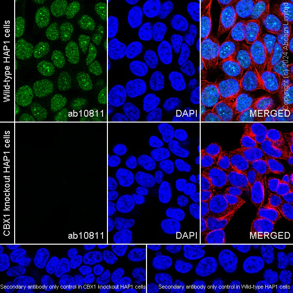 Immunocytochemistry/ Immunofluorescence - Alexa Fluor® 594 Anti-beta Tubulin antibody [EPR16774] - Microtubule Marker (AB206369)