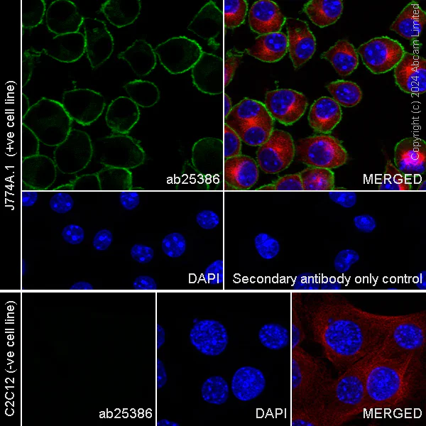 Immunocytochemistry/ Immunofluorescence - Alexa Fluor® 594 Anti-beta Tubulin antibody [EPR16774] - Microtubule Marker (AB206369)