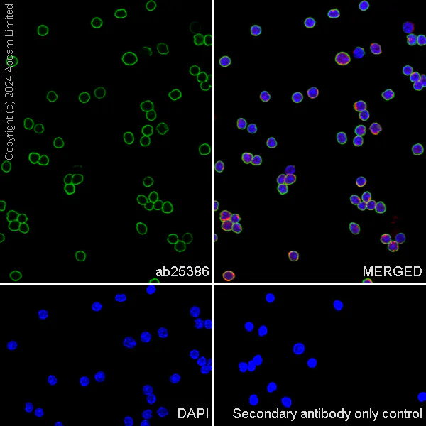 Immunocytochemistry/ Immunofluorescence - Alexa Fluor® 594 Anti-beta Tubulin antibody [EPR16774] - Microtubule Marker (AB206369)