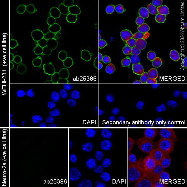 Immunocytochemistry/ Immunofluorescence - Alexa Fluor® 594 Anti-beta Tubulin antibody [EPR16774] - Microtubule Marker (AB206369)