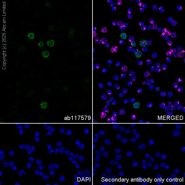 Immunocytochemistry/ Immunofluorescence - Alexa Fluor® 594 Anti-beta Tubulin antibody [EPR16774] - Microtubule Marker (AB206369)