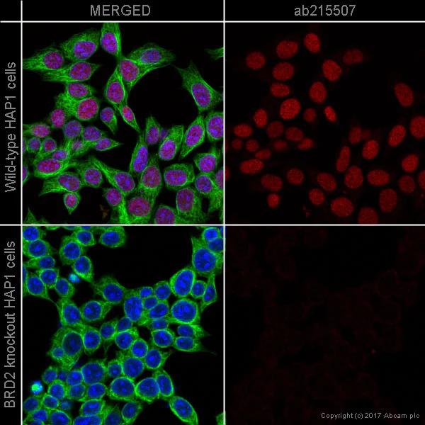 Immunocytochemistry/ Immunofluorescence - Alexa Fluor® 594 Anti-BRD2 antibody [EPR7642] (AB215507)
