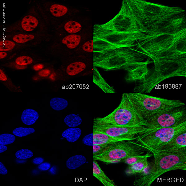Immunocytochemistry - Alexa Fluor® 594 Anti-BRG1 antibody [EPNCIR111A] (AB207052)