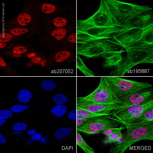 Immunocytochemistry - Alexa Fluor® 594 Anti-BRG1 antibody [EPNCIR111A] (AB207052)