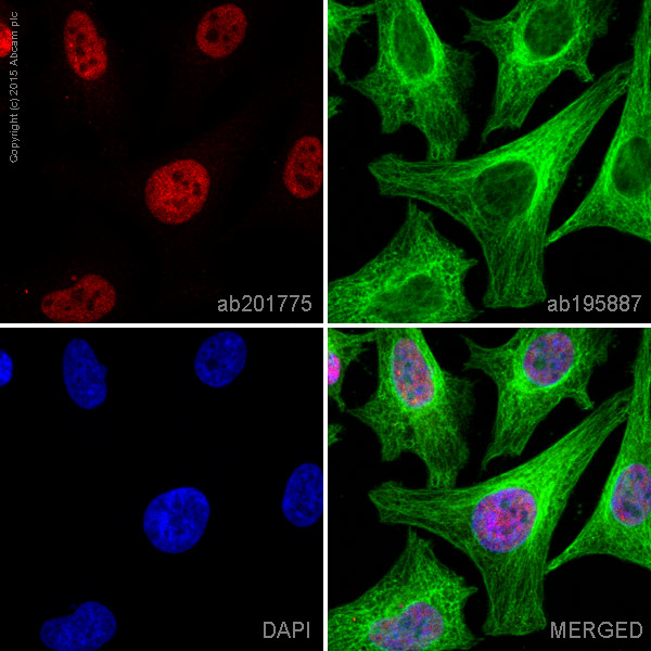 Immunocytochemistry/ Immunofluorescence - Alexa Fluor® 594 Anti-c-Myc antibody [Y69] (AB201775)