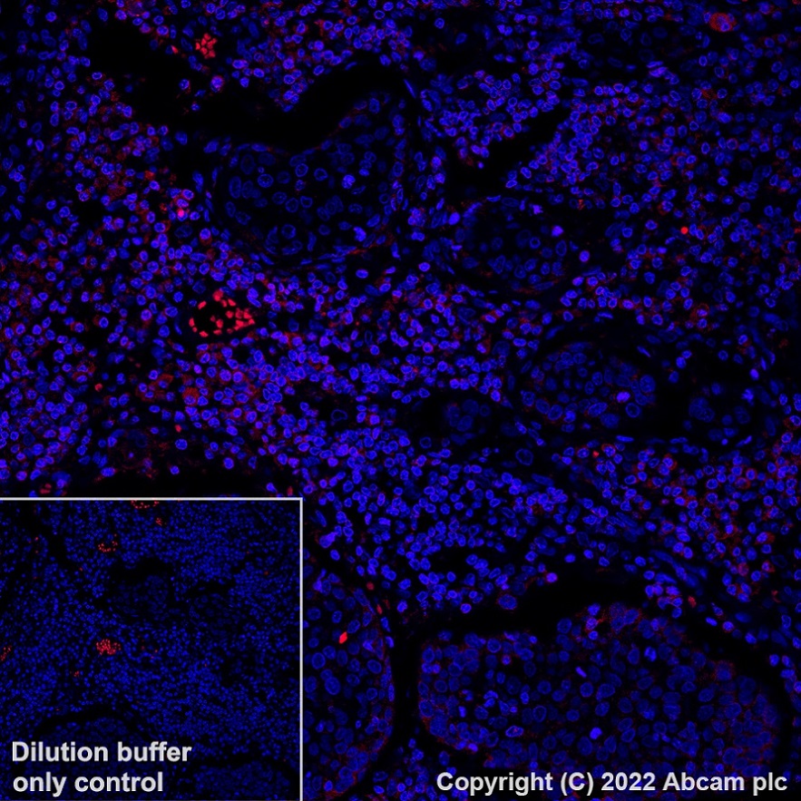 Immunohistochemistry (Formalin/PFA-fixed paraffin-embedded sections) - Alexa Fluor® 594 Anti-CD11a antibody [EP1285Y] (AB315256), expandable thumbnail