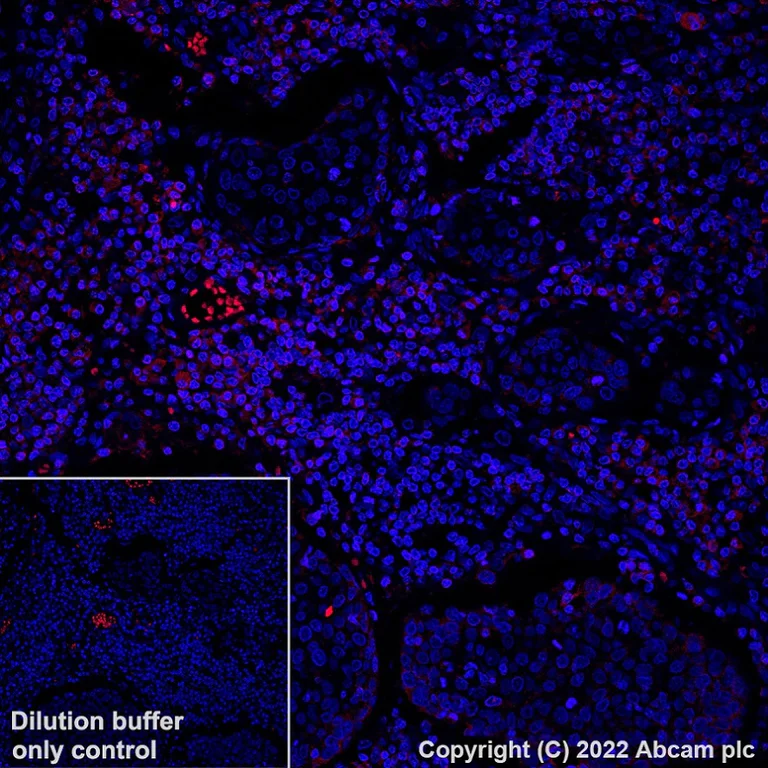 Immunohistochemistry (Formalin/PFA-fixed paraffin-embedded sections) - Alexa Fluor® 594 Anti-CD11a antibody [EP1285Y] (AB315256)