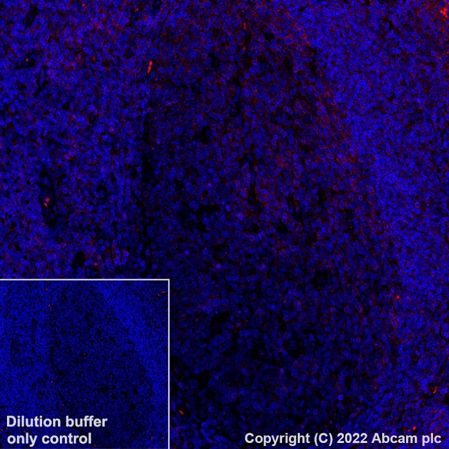 Immunohistochemistry (Formalin/PFA-fixed paraffin-embedded sections) - Alexa Fluor® 594 Anti-CD11a antibody [EP1285Y] (AB315256), expandable thumbnail