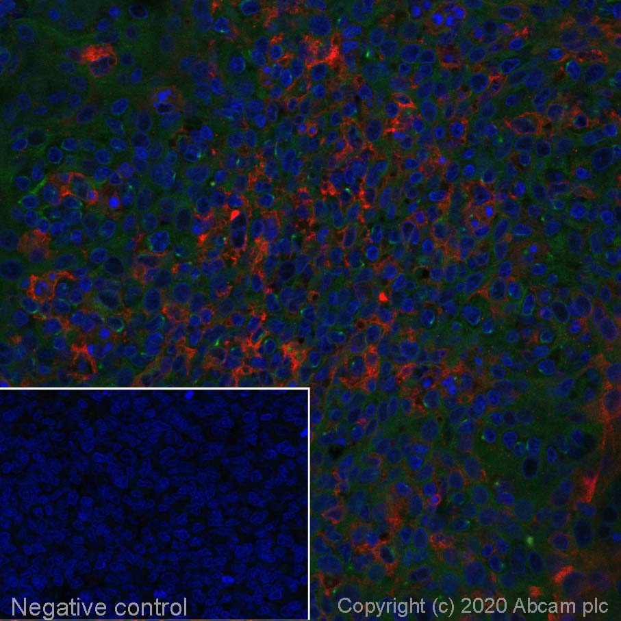 Immunohistochemistry (Formalin/PFA-fixed paraffin-embedded sections) - Alexa Fluor® 594 Anti-CD11c antibody [EP1347Y] (AB277235), expandable thumbnail