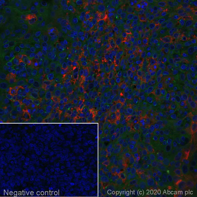 Immunohistochemistry (Formalin/PFA-fixed paraffin-embedded sections) - Alexa Fluor® 594 Anti-CD11c antibody [EP1347Y] (AB277235)
