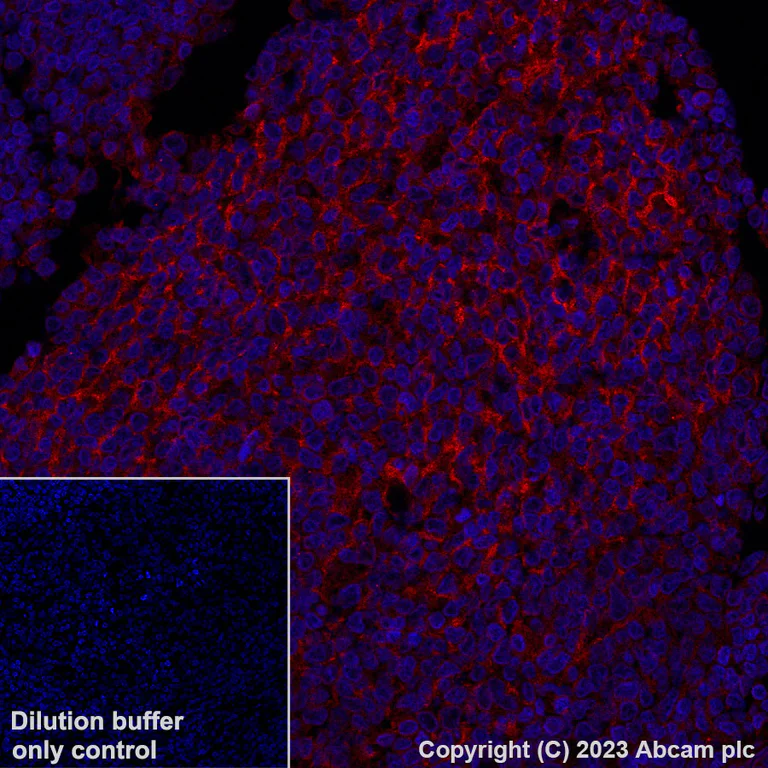 Immunohistochemistry (Formalin/PFA-fixed paraffin-embedded sections) - Alexa Fluor® 594 Anti-CD14 antibody [EPR3653] (AB314340)