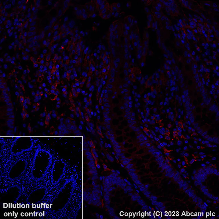 Immunohistochemistry (Formalin/PFA-fixed paraffin-embedded sections) - Alexa Fluor® 594 Anti-CD14 antibody [EPR3653] (AB314340)