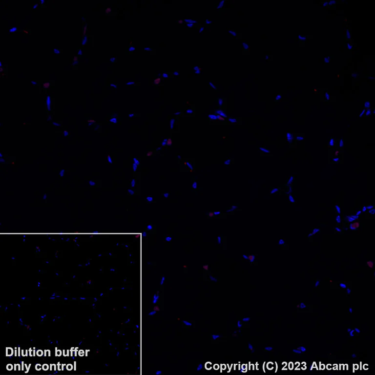Immunohistochemistry (Formalin/PFA-fixed paraffin-embedded sections) - Alexa Fluor® 594 Anti-CD14 antibody [EPR3653] (AB314340)
