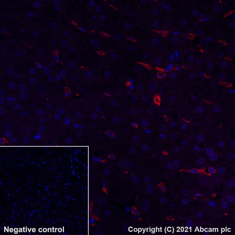 Immunohistochemistry (Formalin/PFA-fixed paraffin-embedded sections) - Alexa Fluor® 594 Anti-CD163 antibody [EPR19518] (AB282114)