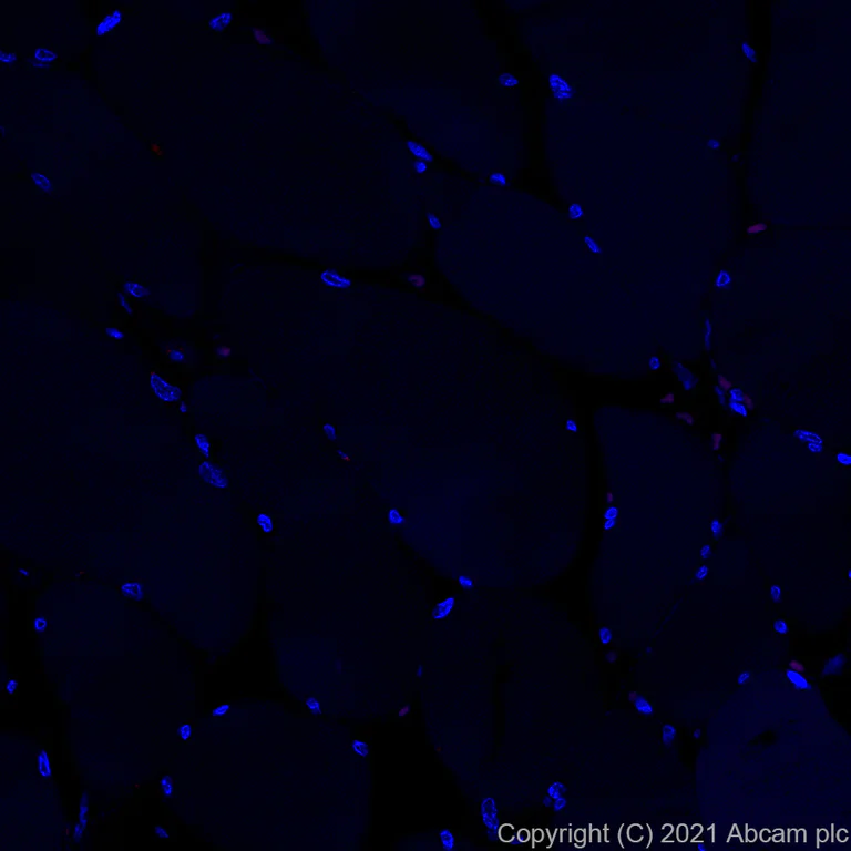 Immunohistochemistry (Formalin/PFA-fixed paraffin-embedded sections) - Alexa Fluor® 594 Anti-CD163 antibody [EPR19518] (AB282114)