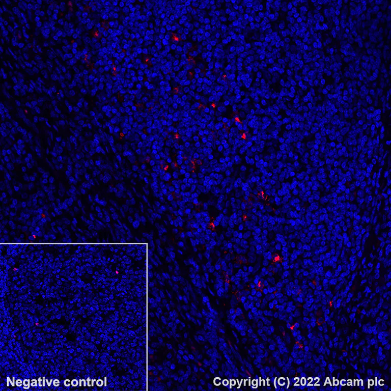 Immunohistochemistry (Formalin/PFA-fixed paraffin-embedded sections) - Alexa Fluor® 594 Anti-CD208 antibody [EPR24265-8] (AB300663)