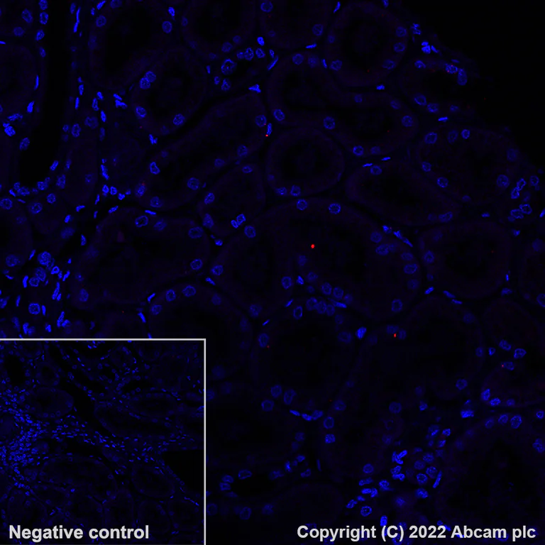 Immunohistochemistry (Formalin/PFA-fixed paraffin-embedded sections) - Alexa Fluor® 594 Anti-CD208 antibody [EPR24265-8] (AB300663)