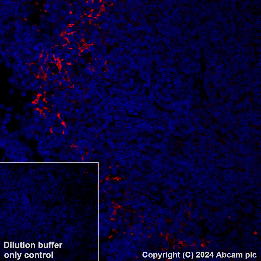 Immunohistochemistry (Formalin/PFA-fixed paraffin-embedded sections) - Alexa Fluor® 594 Anti-CD209B (DC-SIGNR1) antibody [EPR27427-87] (AB317363), expandable thumbnail