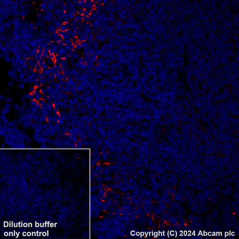 Immunohistochemistry (Formalin/PFA-fixed paraffin-embedded sections) - Alexa Fluor® 594 Anti-CD209B (DC-SIGNR1) antibody [EPR27427-87] (AB317363)