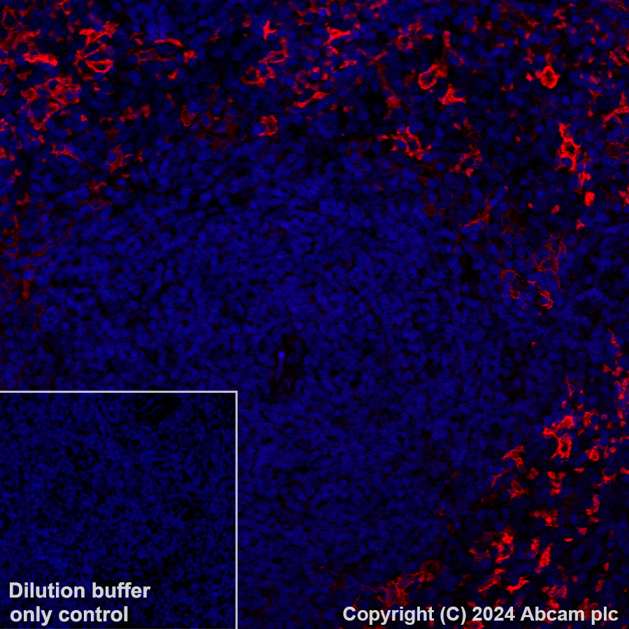 Immunohistochemistry (Formalin/PFA-fixed paraffin-embedded sections) - Alexa Fluor® 594 Anti-CD209B (DC-SIGNR1) antibody [EPR27427-87] (AB317363), expandable thumbnail