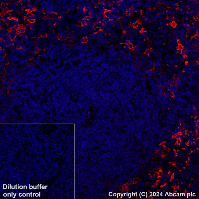 Immunohistochemistry (Formalin/PFA-fixed paraffin-embedded sections) - Alexa Fluor® 594 Anti-CD209B (DC-SIGNR1) antibody [EPR27427-87] (AB317363)