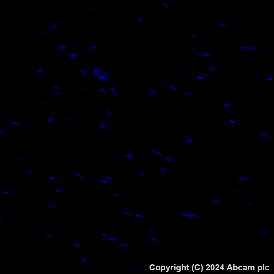 Immunohistochemistry (Formalin/PFA-fixed paraffin-embedded sections) - Alexa Fluor® 594 Anti-CD209B (DC-SIGNR1) antibody [EPR27427-87] (AB317363), expandable thumbnail