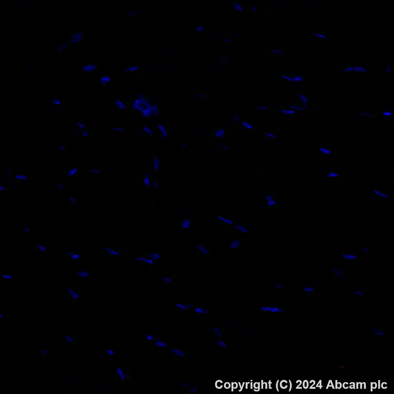 Immunohistochemistry (Formalin/PFA-fixed paraffin-embedded sections) - Alexa Fluor® 594 Anti-CD209B (DC-SIGNR1) antibody [EPR27427-87] (AB317363)