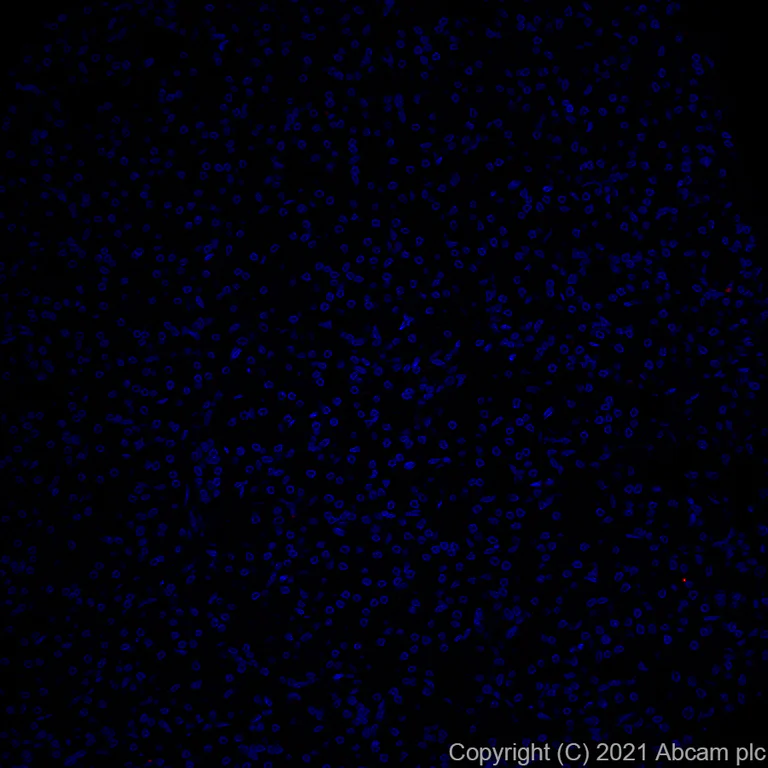 Immunohistochemistry (Formalin/PFA-fixed paraffin-embedded sections) - Alexa Fluor® 594 Anti-CD21 antibody [EP3093] (AB281930)