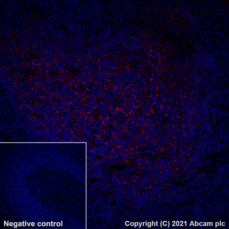 Immunohistochemistry (Formalin/PFA-fixed paraffin-embedded sections) - Alexa Fluor® 594 Anti-CD21 antibody [EP3093] (AB281930)