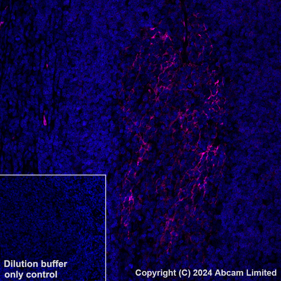 Immunohistochemistry (Formalin/PFA-fixed paraffin-embedded sections) - Alexa Fluor® 594 Anti-CD23 antibody [EPR3617] (AB322229), expandable thumbnail