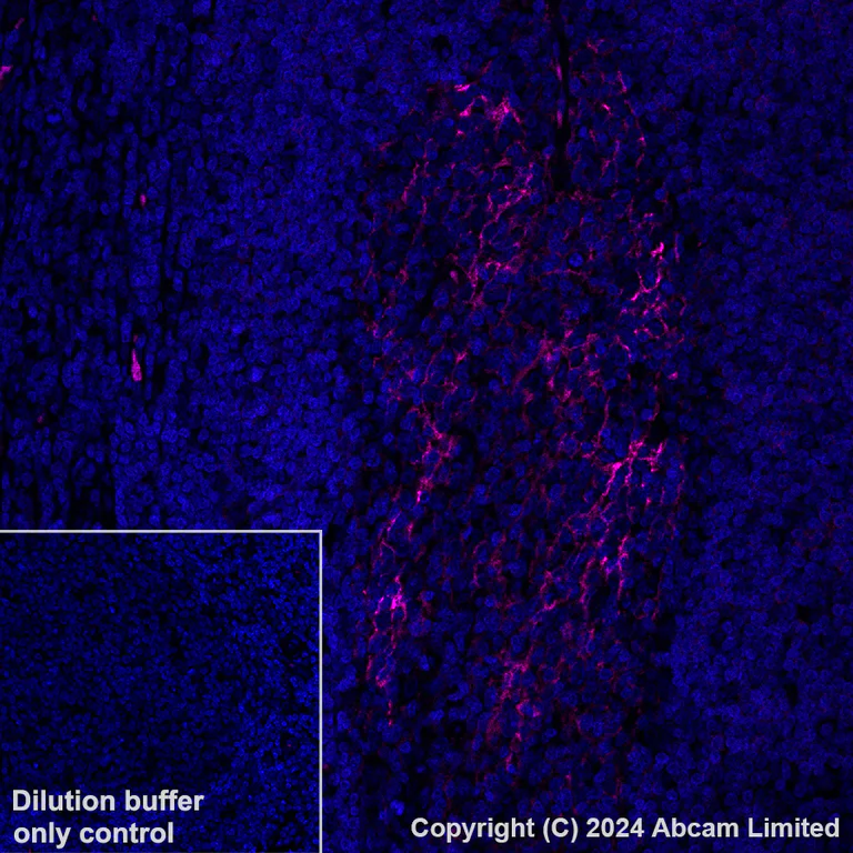Immunohistochemistry (Formalin/PFA-fixed paraffin-embedded sections) - Alexa Fluor® 594 Anti-CD23 antibody [EPR3617] (AB322229)