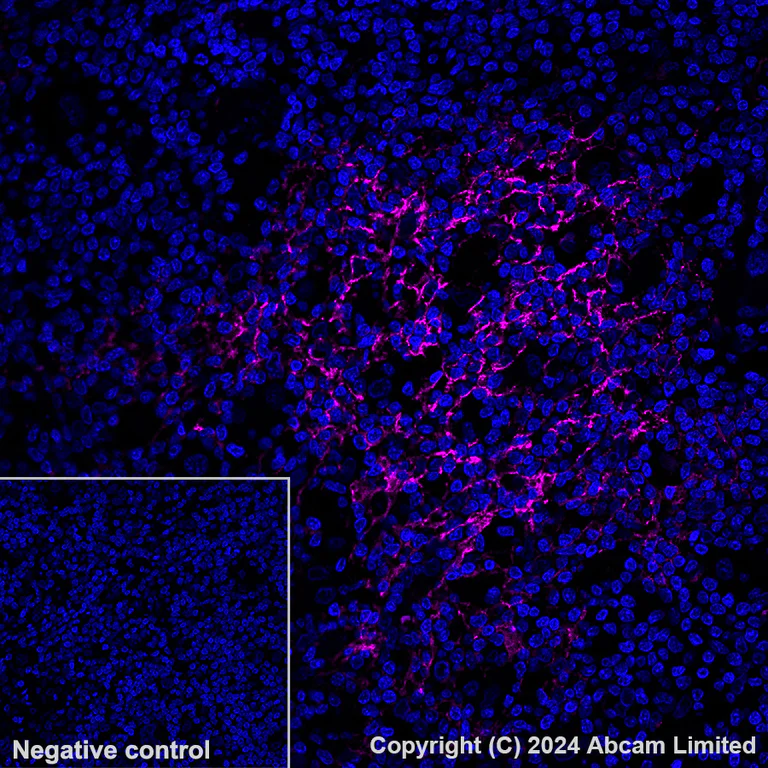 Immunohistochemistry (Formalin/PFA-fixed paraffin-embedded sections) - Alexa Fluor® 594 Anti-CD23 antibody [EPR3617] (AB322229)