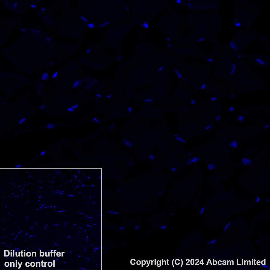 Immunohistochemistry (Formalin/PFA-fixed paraffin-embedded sections) - Alexa Fluor® 594 Anti-CD23 antibody [EPR3617] (AB322229), expandable thumbnail