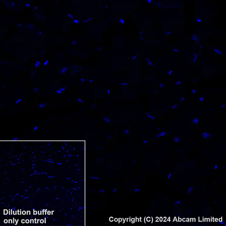 Immunohistochemistry (Formalin/PFA-fixed paraffin-embedded sections) - Alexa Fluor® 594 Anti-CD23 antibody [EPR3617] (AB322229)