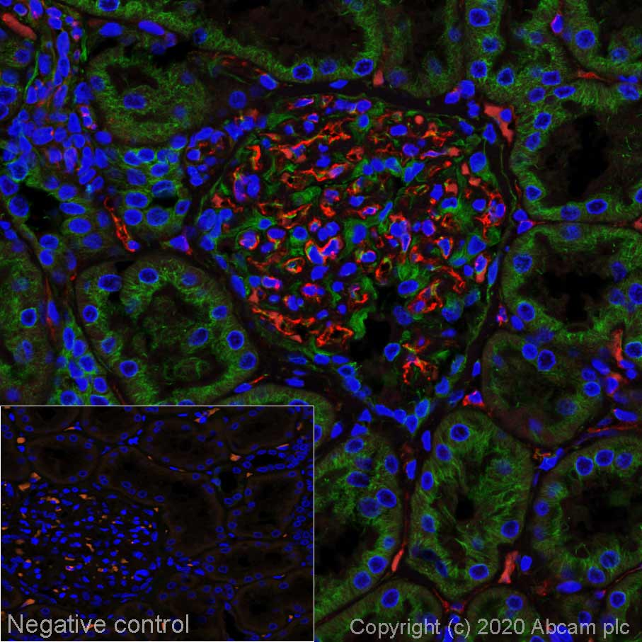 Immunohistochemistry (Formalin/PFA-fixed paraffin-embedded sections) - Alexa Fluor® 594 Anti-CD31 antibody [EPR3094] (AB277231), expandable thumbnail