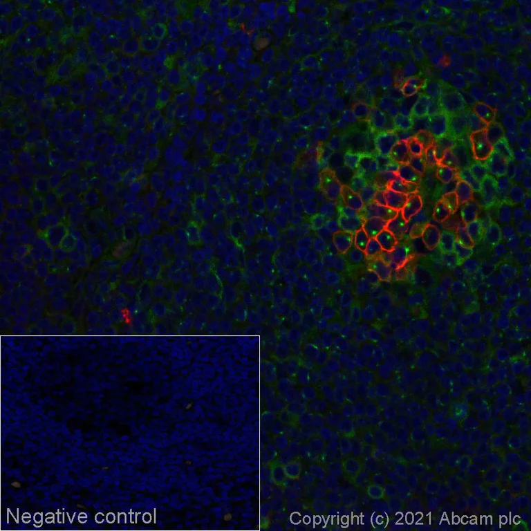Immunohistochemistry (Formalin/PFA-fixed paraffin-embedded sections) - Alexa Fluor® 594 Anti-CD38 antibody [EPR4106] (AB280842)