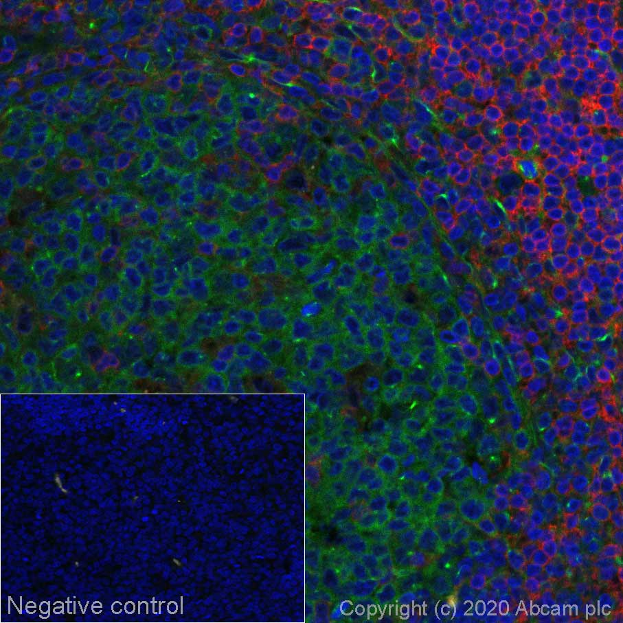 Immunohistochemistry (Formalin/PFA-fixed paraffin-embedded sections) - Alexa Fluor® 594 Anti-CD4 antibody [EPR6855] (AB277931), expandable thumbnail