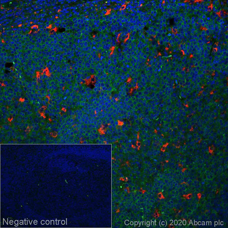 Immunohistochemistry (Formalin/PFA-fixed paraffin-embedded sections) - Alexa Fluor® 594 Anti-CD68 antibody [EPR20545] (AB277938)