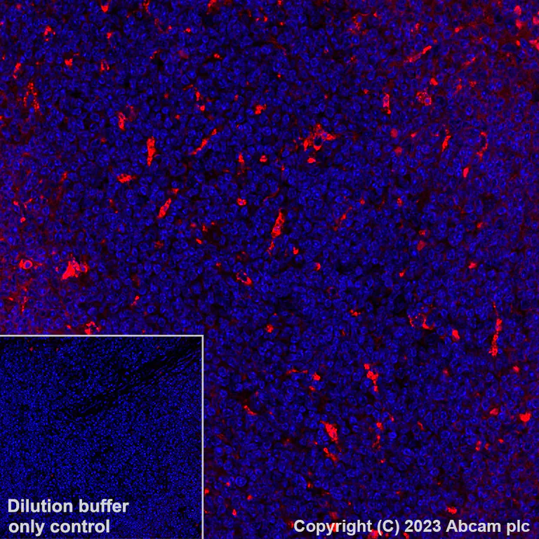 Immunohistochemistry (Formalin/PFA-fixed paraffin-embedded sections) - Alexa Fluor® 594 Anti-CD68 antibody [EPR23917-164] (AB312903)