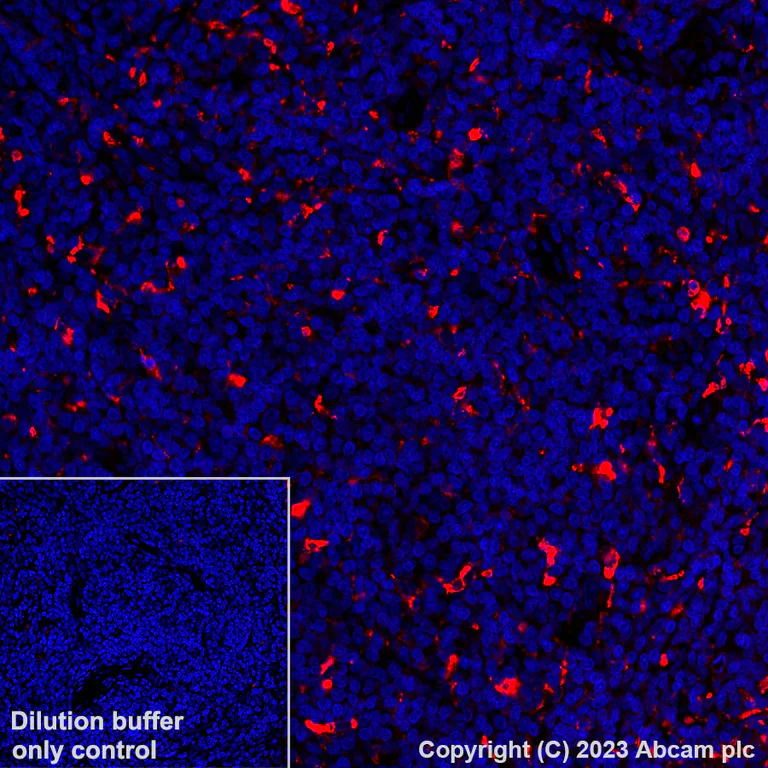 Immunohistochemistry (Formalin/PFA-fixed paraffin-embedded sections) - Alexa Fluor® 594 Anti-CD68 antibody [EPR23917-164] (AB312903)